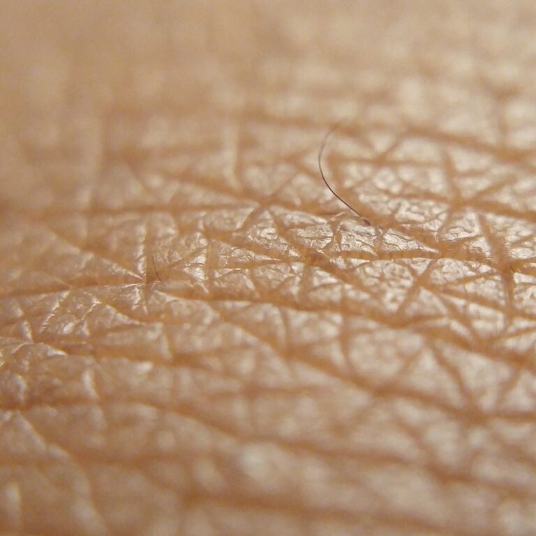 Manchester Cancer Research Centre - Can a simple blood test spot the signs of skin cancer returning?