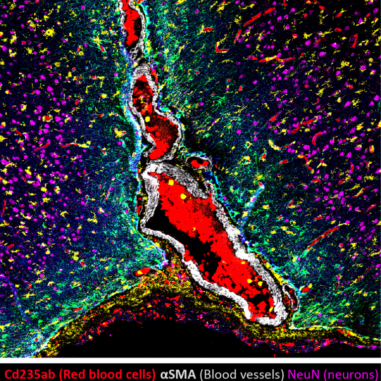 Manchester Cancer Research Centre - BRAINatomy 1
